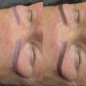 Antes e depois (neutralização com pigmento Hot Repair) de uma correção de sobrecelhas que estava cinzas