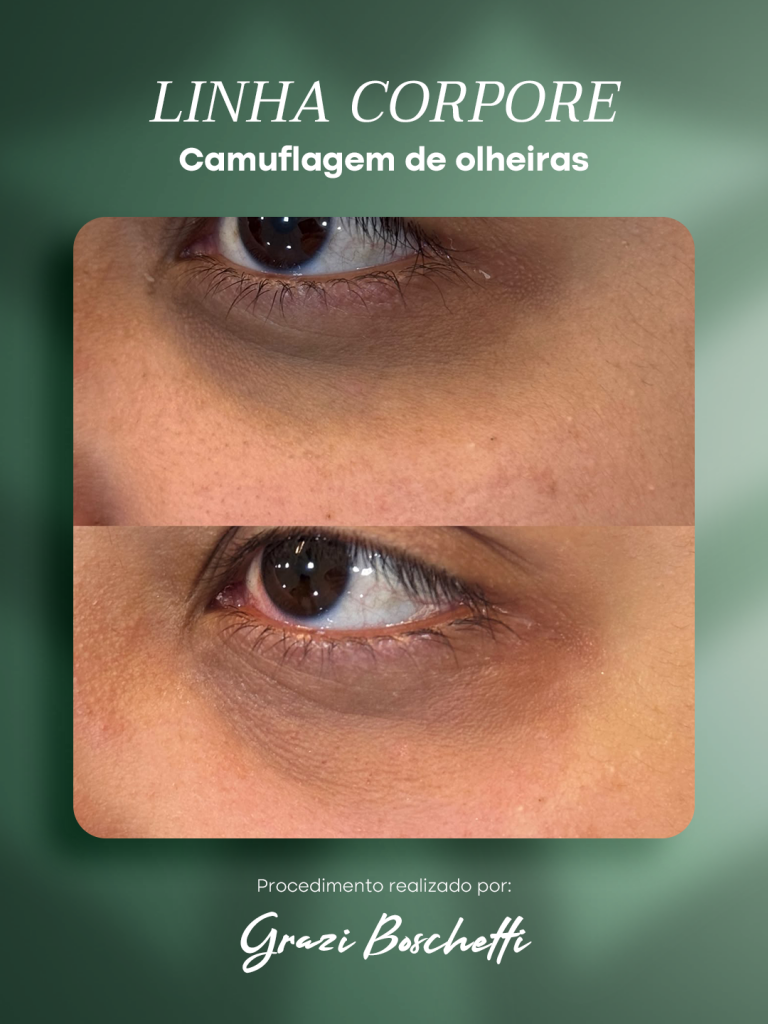 Linha Corpore pigmentos estratégicos para uso clínico