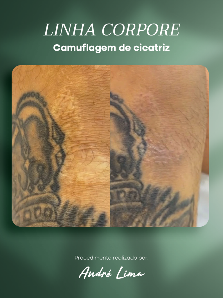 Linha Corpore pigmentos estratégicos para uso clínico